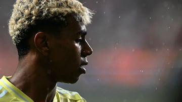 这是足协方, 何伤病 这是足协方, 何伤病